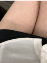 クリステル - ゆまの女の子ブログ画像