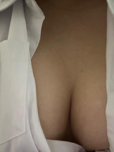 CHERRY 本店 - ゆきの女の子ブログ画像