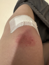 ZOOM - ミナの女の子ブログ画像