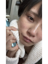 はだえぷ - るいの女の子ブログ画像