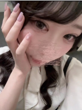 after5 - りんの女の子ブログ画像