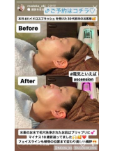 PURITY - セリーヌの女の子ブログ画像