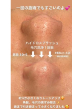 PURITY - セリーヌの女の子ブログ画像